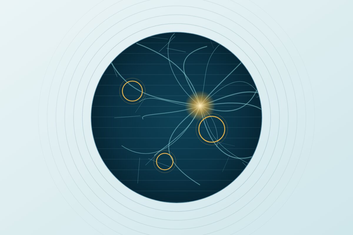 Imagen de fondo de ojo con marcas de detección asistida por inteligencia artificial